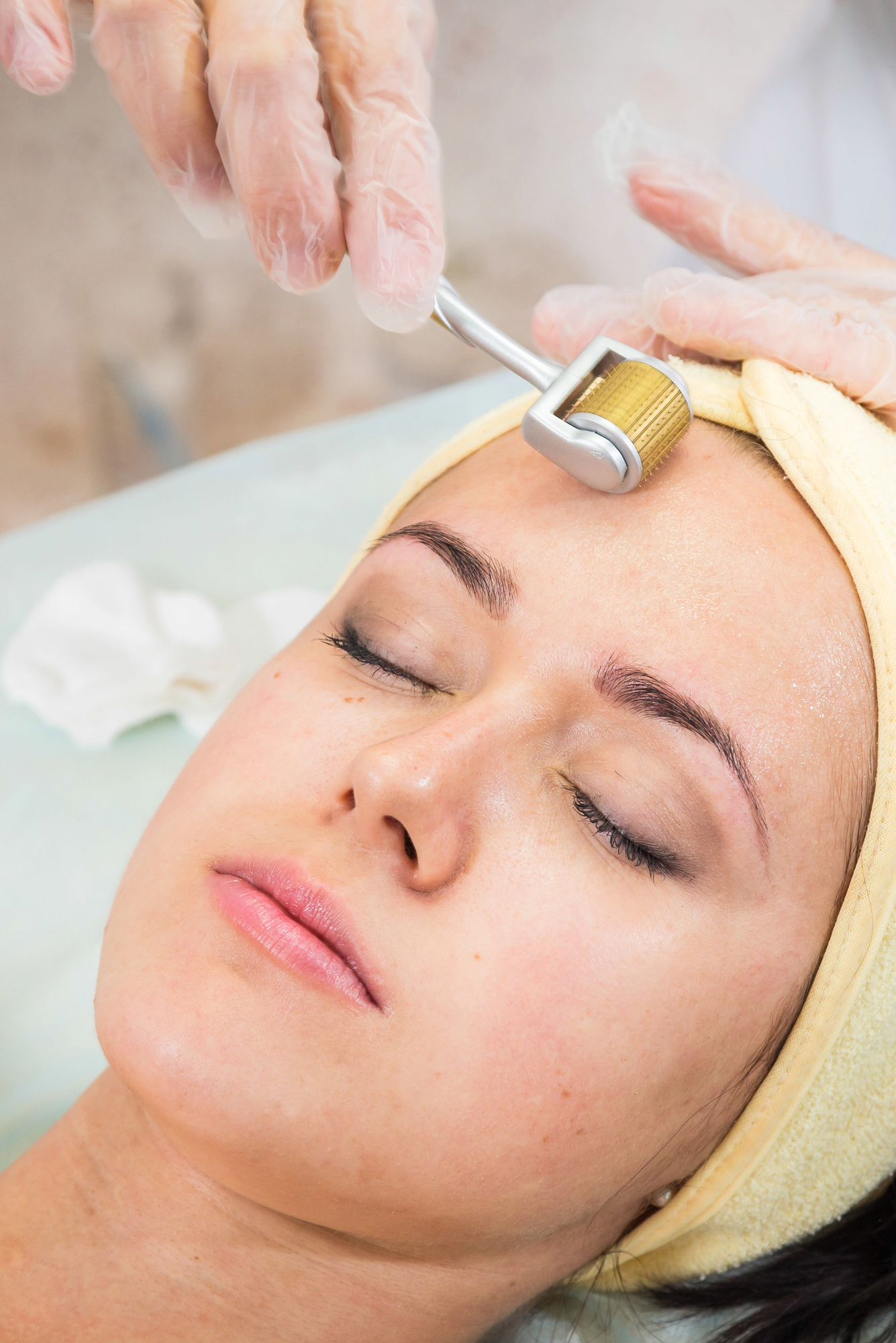 Hals-Liposuktion mit Dermaroller™ bei Dr. Heitland in München