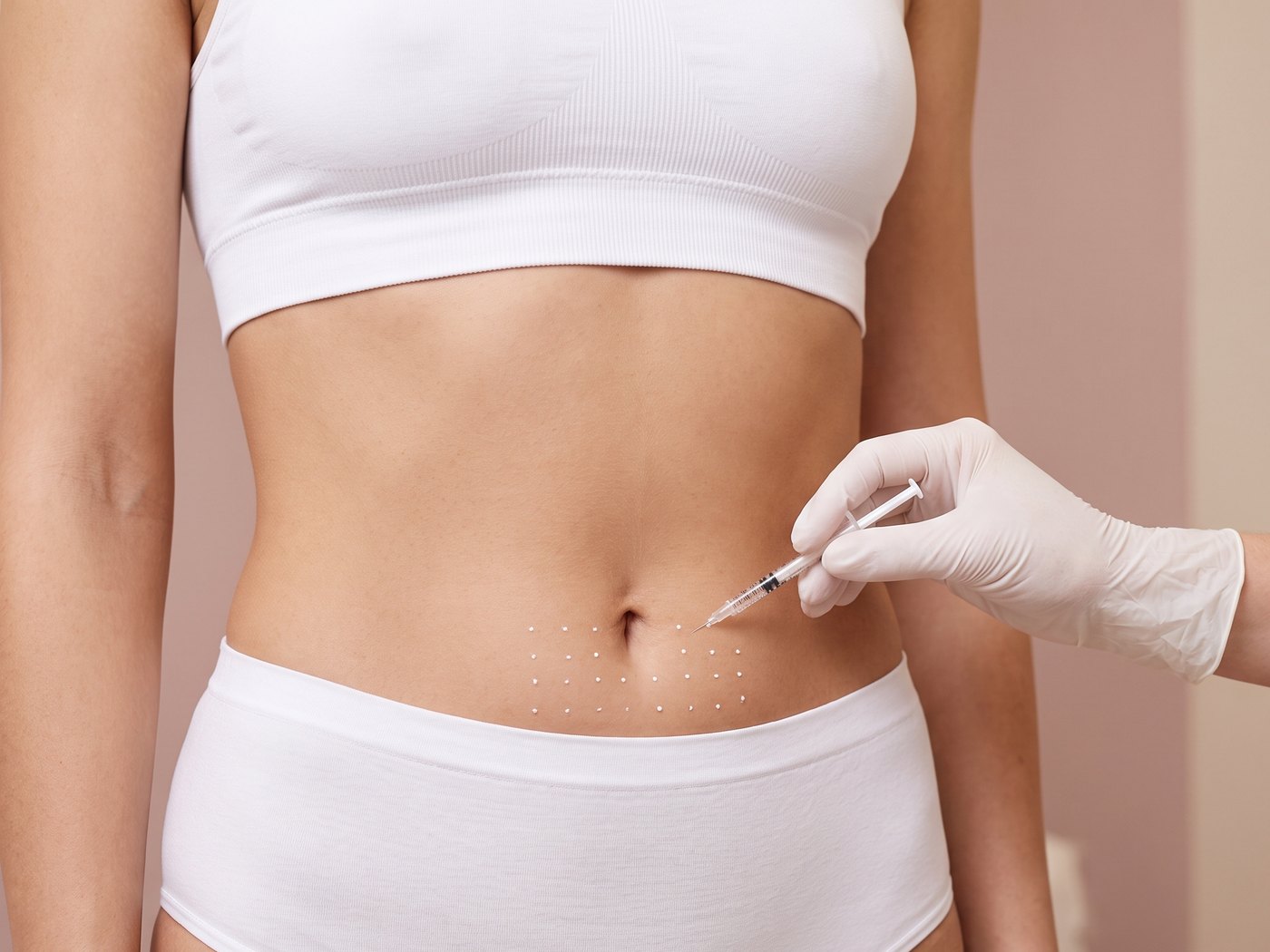 Fett-weg-Spritze am Bauch: Injektion in das markierte Fettpolster